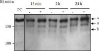 Anti-Human Kappa Light Chains (Bound and Free)Peroxidase antibody produced in goat 