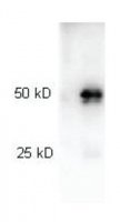 Anti-Rabbit IgG (H+L), highly cross adsorbed-Peroxidase antibody produced in goat SAB3700885-2MG