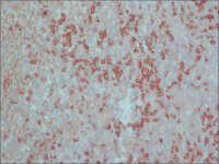 Anti-Rat IgG (whole molecule)Peroxidase antibody produced in rabbit A9542-2ML