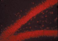 Donkey Anti-Mouse IgG Antibody, Rhodamine conjugate, Species Adsorbed AP192R