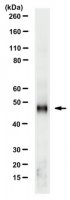 Anti-Adenosylhomocysteinase (AHCY) 