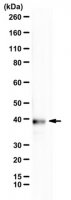 Anti-alpha-synuclein N103 fragment 