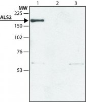 Anti-ALS2 (N-terminal region) antibody produced in rabbit