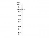 Anti-Anoctamin-1 (TMEM16A) 