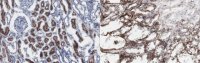 Anti-APN/CD13 Antibody, clone DF-5 