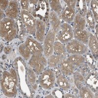 Anti-ARHGDIA antibody produced in rabbit 