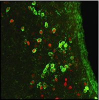 Anti-ARP2 antibody, Mouse monoclonal