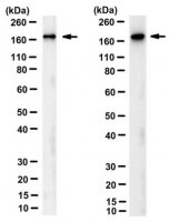 Anti-ASPP2 (TP53BP2) Antibody, clone DX54.10 