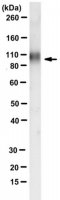 Anti-Autotaxin (ENPP2) Antibody, clone 7A5 