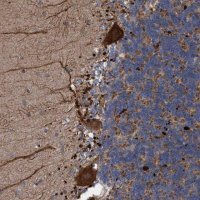 Anti-BBS9 antibody produced in rabbit 