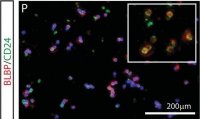 Anti-Brain lipid binding protein Antibody 