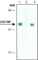 Anti-CACYBP antibody,Mouse monoclonal 
