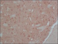 Anti-Calcineurin (-Subunit) antibody, Mouse monoclonal 