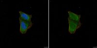 Anti-Calcipressin-1 