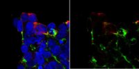 Anti-Cas9 