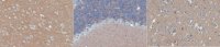 Anti-Catenin delta-2 Antibody, clone 4H2.1 