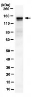 Anti-Catenin delta-2 Antibody, clone 4H2.1 