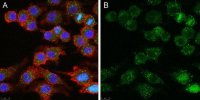 Anti-CD25 Antibody, clone 7D4 