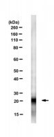 Anti-Cdc42 Antibody, clone 28-10 