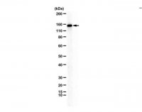 Anti-CEP135 