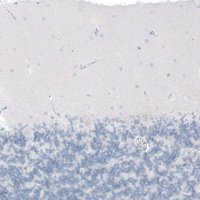 Anti-CFTR antibody produced in rabbit