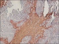 Anti-Chondroitin Sulfate antibody, Mouse monoclonal 