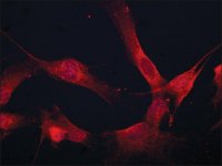 Anti-Coronin 1B antibody produced in rabbit 