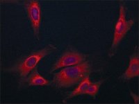 Anti-Coronin-1C (C-terminal) antibody produced in rabbit 