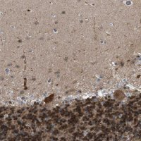 Anti-CRTC1 antibody produced in rabbit 