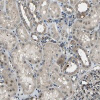 Anti-CTIF antibody produced in rabbit 