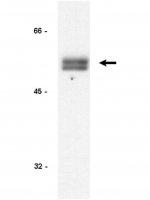 Anti-Cyclin E Antibody, clone HE12 