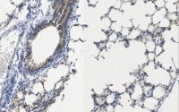 Anti-Cytokeratin 19 Antibody, clone TROMA-3 