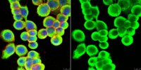 Anti-Cytokeratin 8/18 Antibody, clone L2A1 