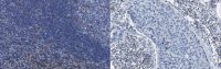 Anti-DAG Kinase Alpha Antibody, clone 10D6.1