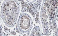 Anti-Daxx Antibody, clone Daxx5.14 