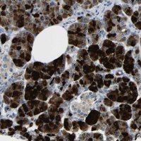 Anti-DCP1A antibody produced in rabbit 