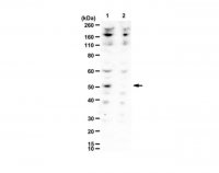 Anti-Dcp2 