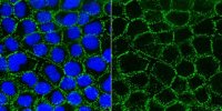 Anti-Desmoglein 2 Antibody, clone 6D8 
