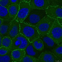 Anti-Desmoplakin Antibody, clone 20B6 