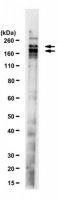 Anti-ESET (SETDB1) Antibody, clone F0808 