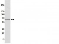 Anti-Estrogen Receptor Antibody, clone 60C, rabbit monoclonal 