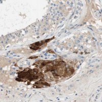 Anti-FDFT1 antibody produced in rabbit 