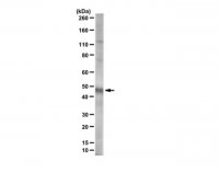 Anti-Ferrochelatase