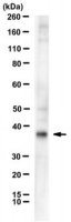 Anti-FGF23 Antibody, clone 278-2 