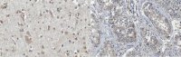 Anti-FMR1polyG Antibody, clone 8FM-2F7 