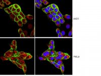 Anti-FOXO1 Antibody, clone 2H8.2 