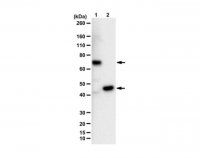 Anti-FtsZ (GTPase) 