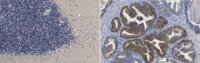 Anti-GABARAPL2 