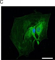 Anti-Glial Fibrillary Acidic Protein antibody produced in rabbit 
