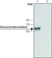Anti-Glucocerebrosidase (C-terminal) antibody produced in rabbit 